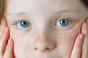 Bőrpigmentáció az arcon: kezelés típusai és módszerei
