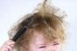 Чому у дитини погано росте волосся?