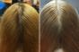 Hatékony módszerek az ősz haj befedésére természetes gyógymódokkal Hogyan festsük be a haj gyökereit, ha sok ősz haja van